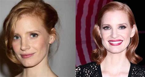 jessica chastain plastic surgery|Jessica Chastain Plastic Surgery: Did She Really Go Under the。